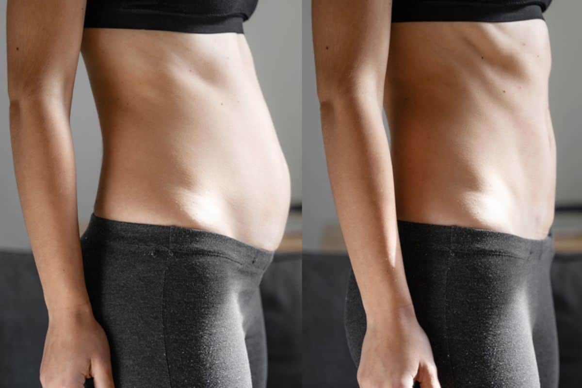 Post-Pregnancy: What Happens to Your Abdominal Muscles After Birth Petersfield