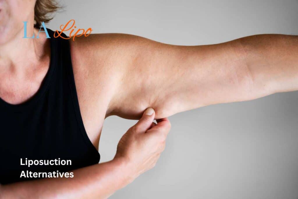 liposuction