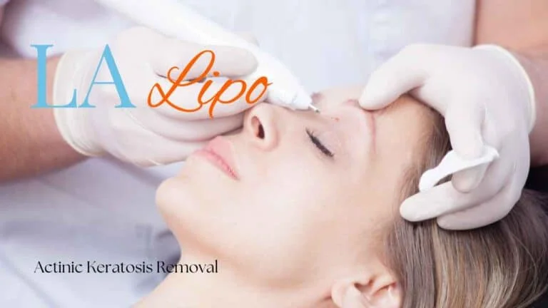 Woman receiving Actinic Keratosis Removal Treatment Petersfield