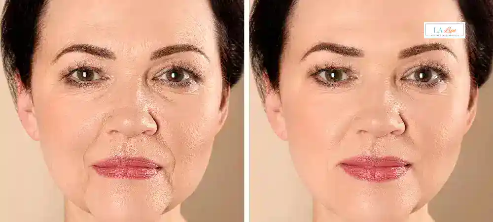 Why Aren’t My Skincare Products Making My Sagging Skin Look Firmer Petersfield?