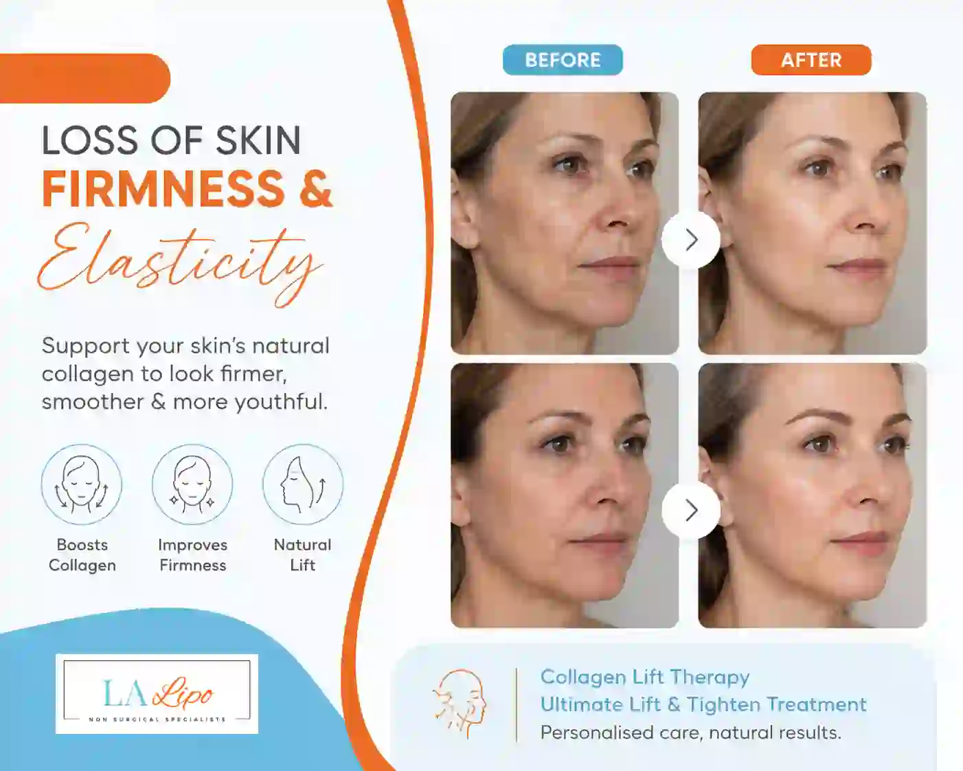 Sign #7: Loss of Skin Firmness and Elasticity Petersfield