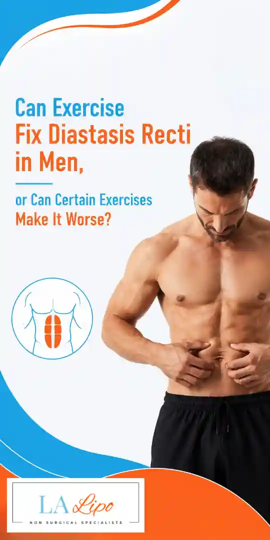 Can Exercise Fix Diastasis Recti in Men, or Can Certain Exercises Make It Worse Petersfield?